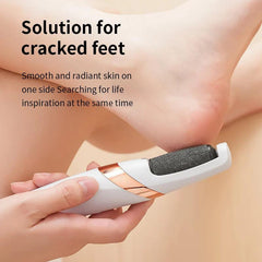Electric Foot Callus Remover – Rechargeable Pedicure Tool