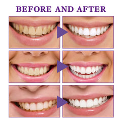 Tooth Cleaning Mousse